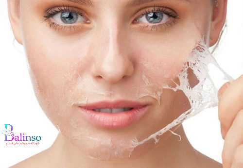 راه های تضمینی برای از بین بردن و درمان جای جوش